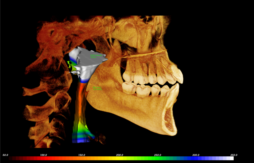 CBCT Scanner